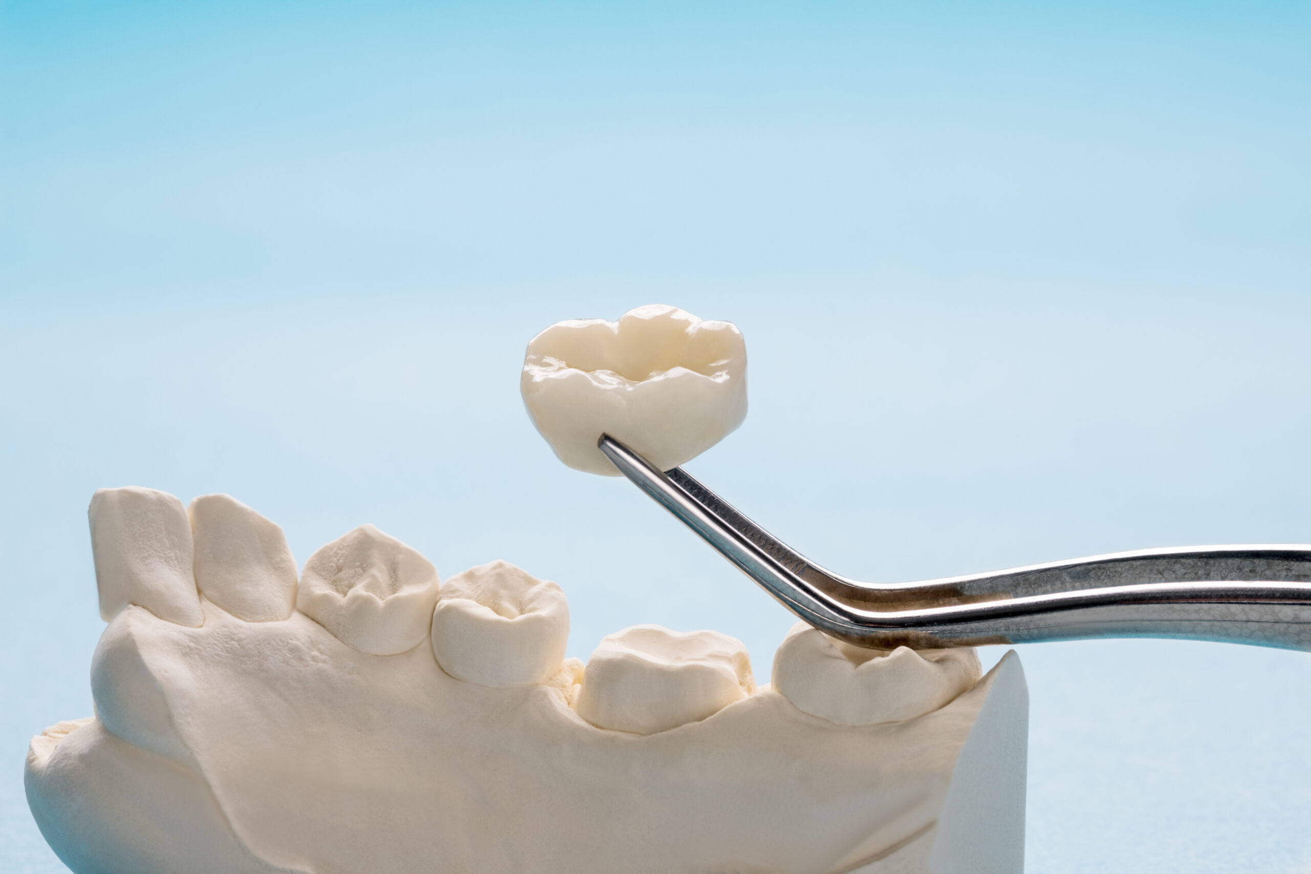 AdobeStock 338299260 scaled - Olympia Hills Family Dental