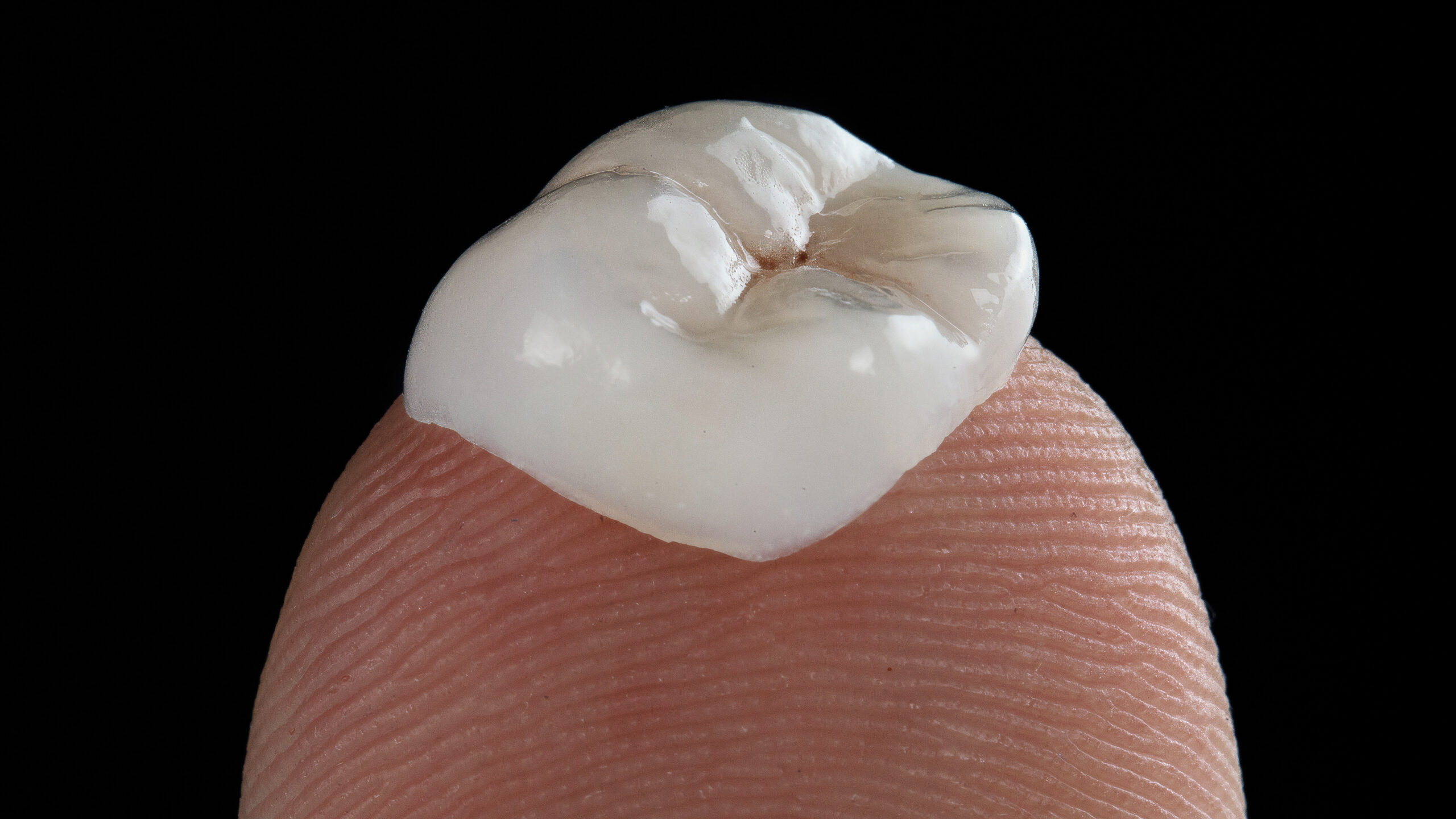 dental inlay made of ceramics on the doctor's finger with a texture on a black background