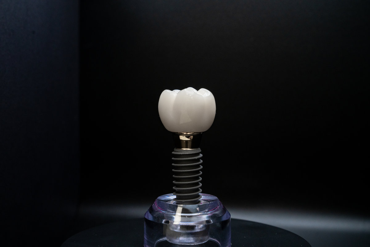 Should You Choose a Dental Implant Over a Bridge