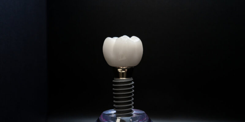 Dental Implant