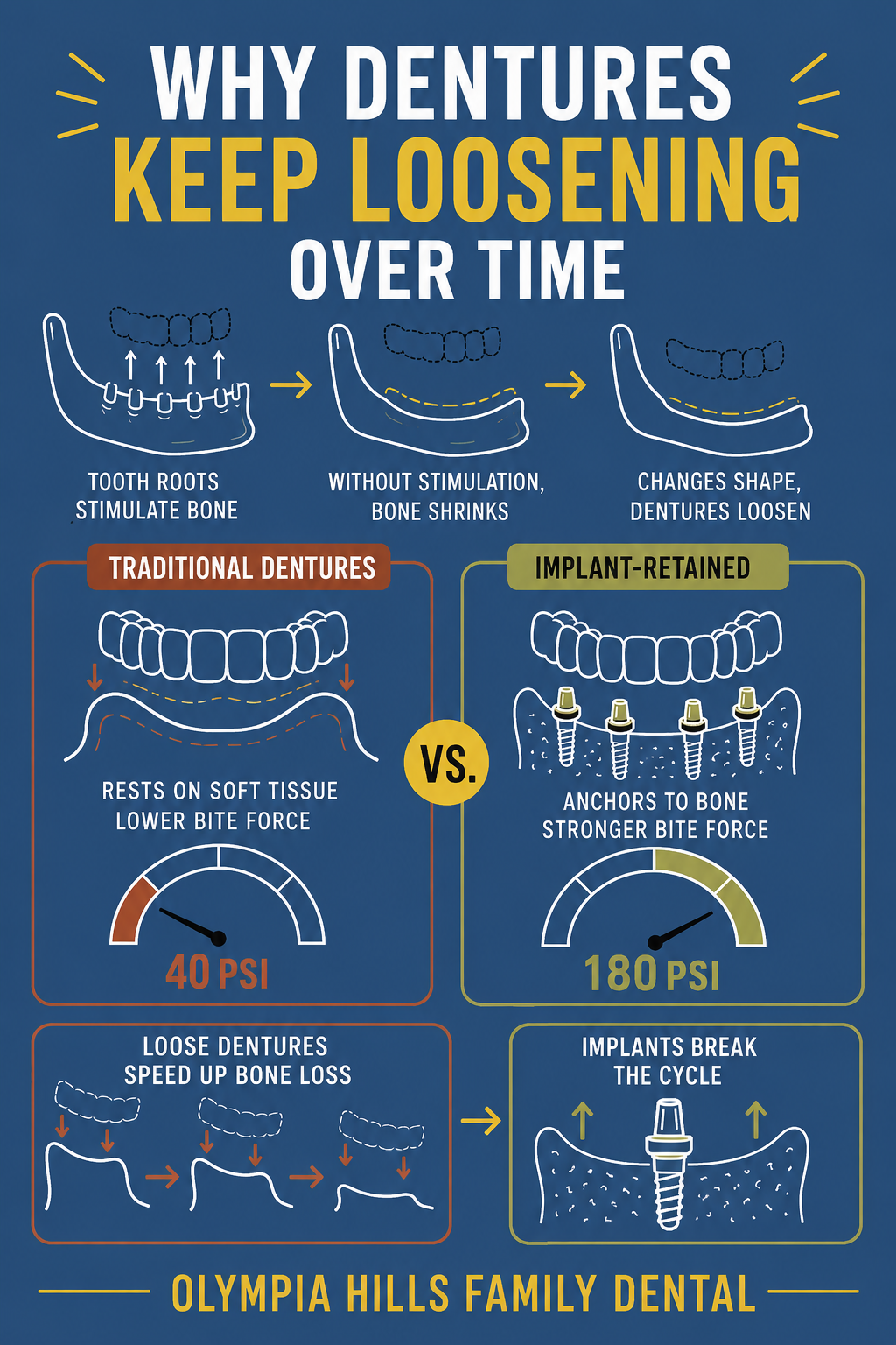 Infographic showing how dental implants stabilize dentures and prevent bone loss